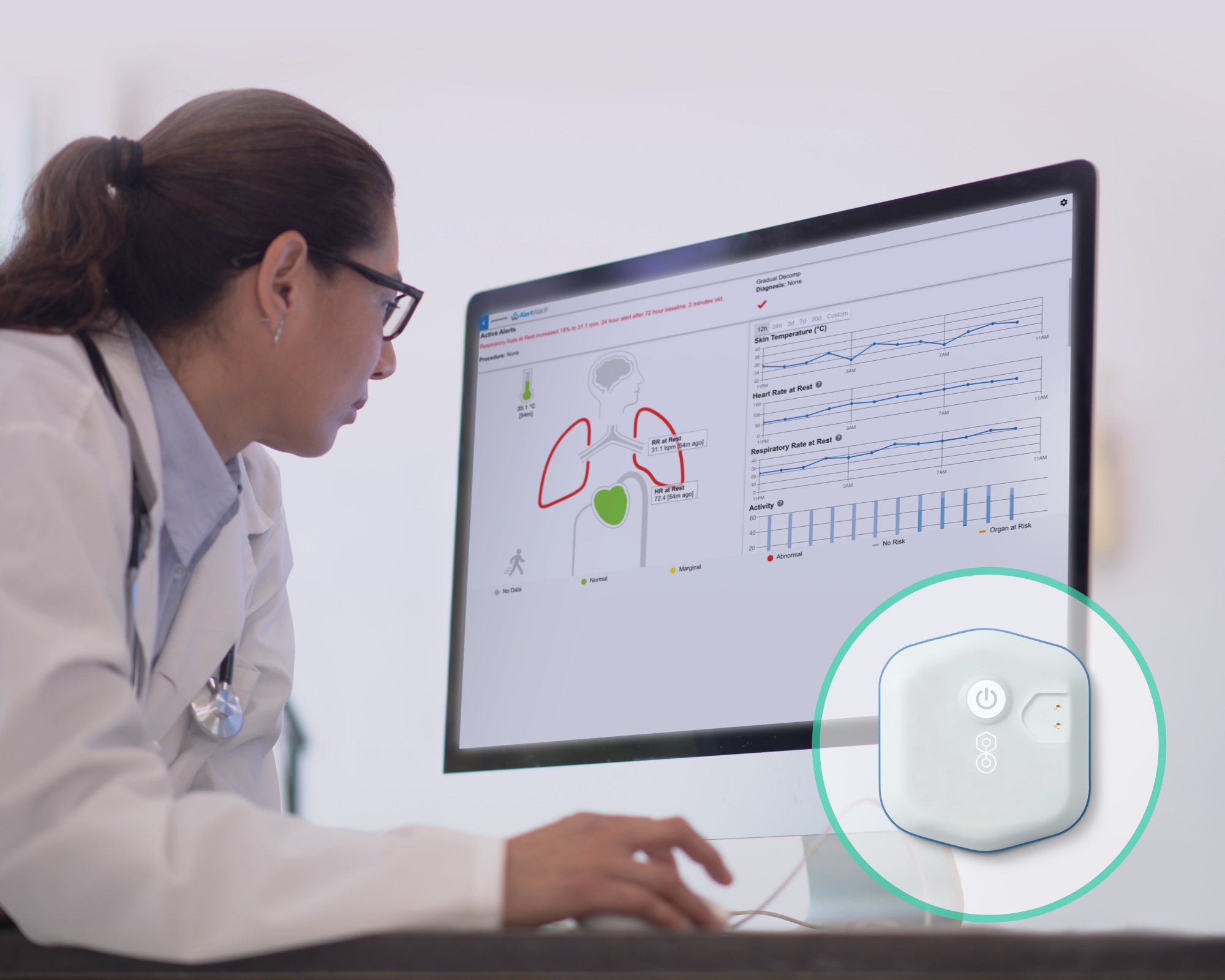 Physician Looking at AlertWatch on Monitor Physician Looking at AlertWatch on Monitor
